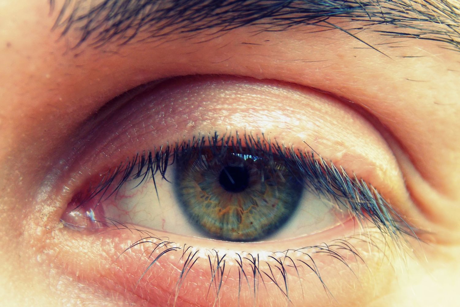 Jak se zbavit oteklých oči z alergie?